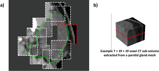 Figure 3 for Unsupervised correspondence with combined geometric learning and imaging for radiotherapy applications