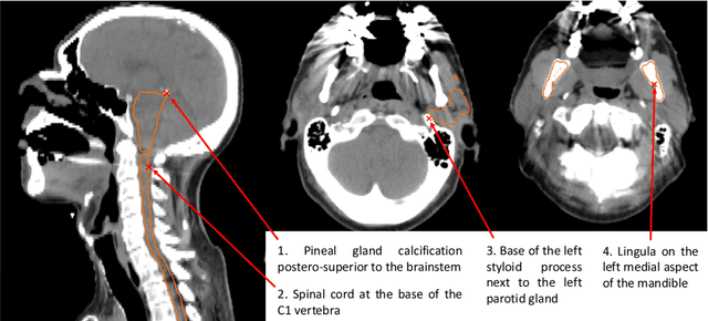 Figure 4 for Unsupervised correspondence with combined geometric learning and imaging for radiotherapy applications