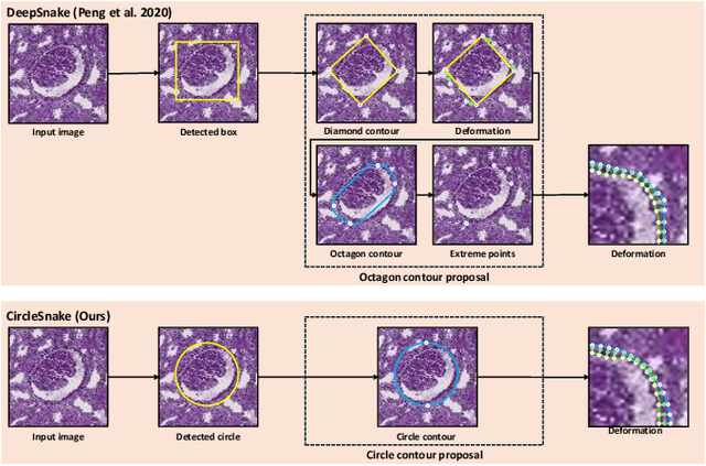 Figure 2 for Circle Representation for Medical Instance Object Segmentation