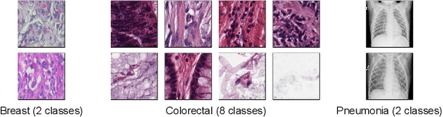 Figure 3 for Exploring Self-Supervised Representation Learning For Low-Resource Medical Image Analysis