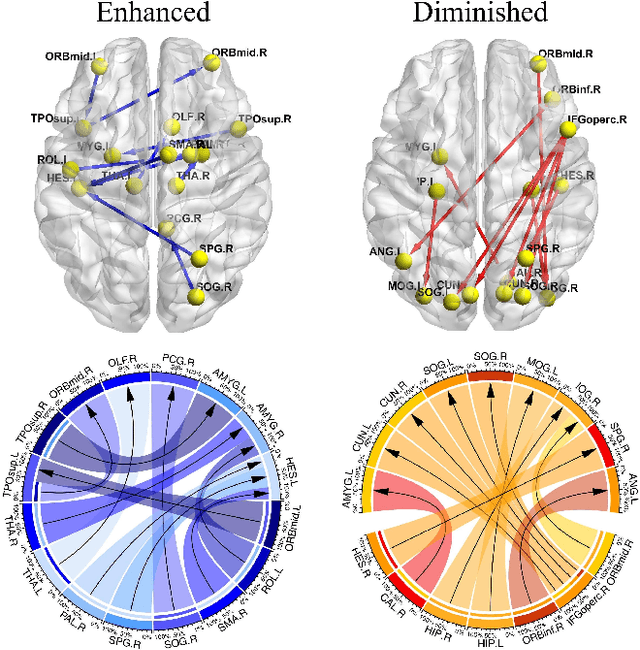 Figure 2 for Multi-resolution Spatiotemporal Enhanced Transformer Denoising with Functional Diffusive GANs for Constructing Brain Effective Connectivity in MCI analysis