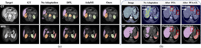 Figure 4 for Source-Free Domain Adaptation for Medical Image Segmentation via Prototype-Anchored Feature Alignment and Contrastive Learning