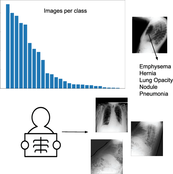Figure 1 for CheXFusion: Effective Fusion of Multi-View Features using Transformers for Long-Tailed Chest X-Ray Classification