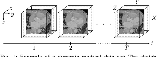 Figure 1 for Compression of Dynamic Medical CT Data Using Motion Compensated Wavelet Lifting with Denoised Update