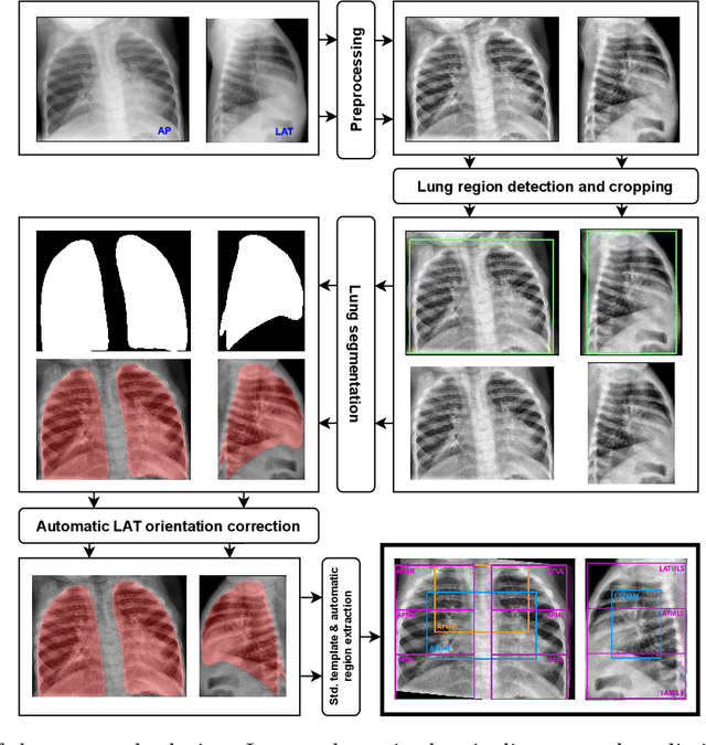 Figure 1 for Deep learning-based lung segmentation and automatic regional template in chest X-ray images for pediatric tuberculosis