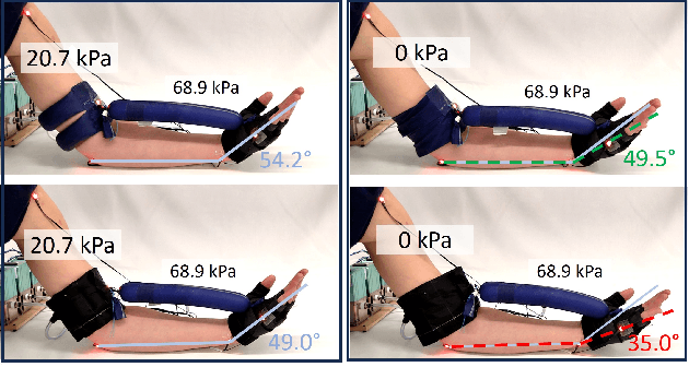 Figure 2 for Stretchable Pneumatic Sleeve for Adaptable, Low-Displacement Anchoring in Exosuits