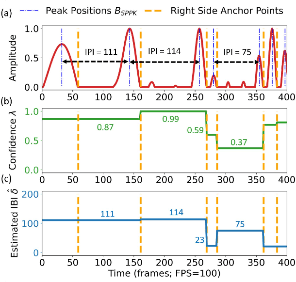 Figure 4 for Local Periodicity-Based Beat Tracking for Expressive Classical Piano Music