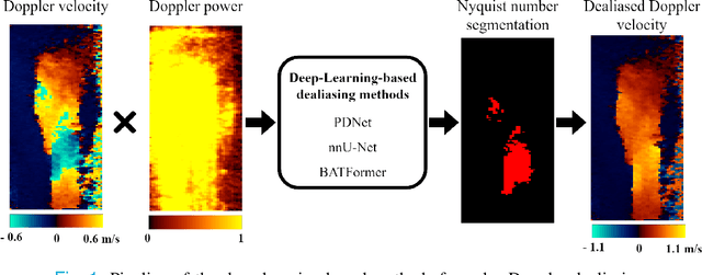 Figure 1 for Phase Unwrapping of Color Doppler Echocardiography using Deep Learning