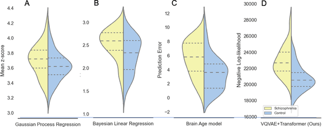 Figure 2 for Transformer-based normative modelling for anomaly detection of early schizophrenia