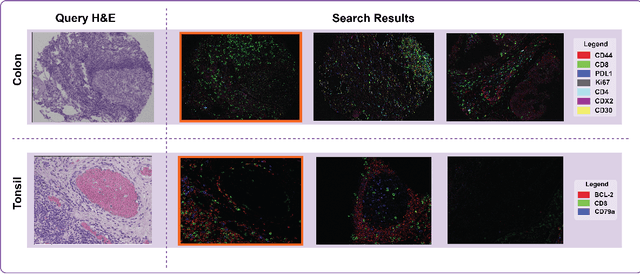Figure 4 for Multimodal Pathology Image Search Between H&E Slides and Multiplexed Immunofluorescent Images