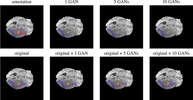 Figure 3 for Does an ensemble of GANs lead to better performance when training segmentation networks with synthetic images?