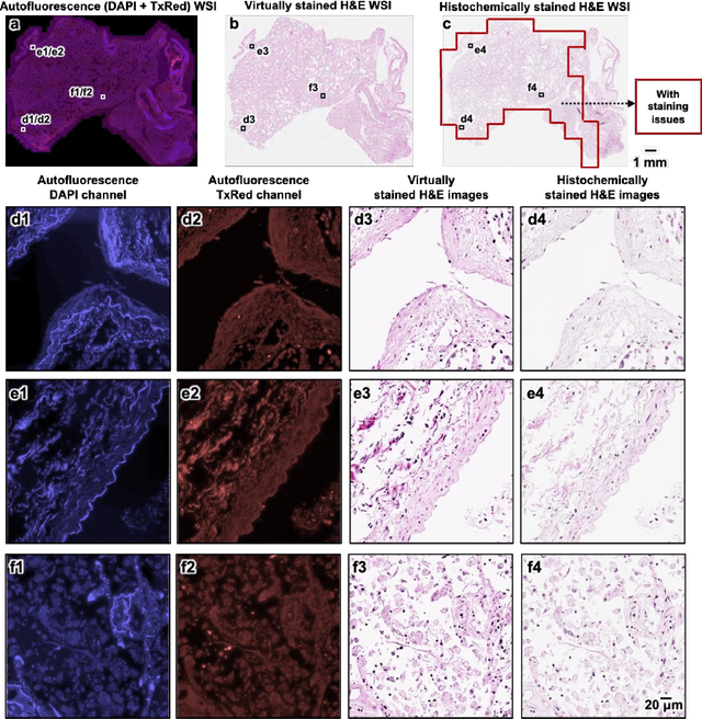 Figure 4 for Virtual histological staining of unlabeled autopsy tissue