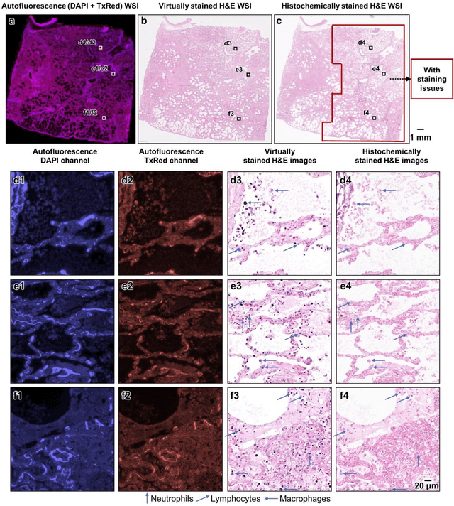 Figure 3 for Virtual histological staining of unlabeled autopsy tissue