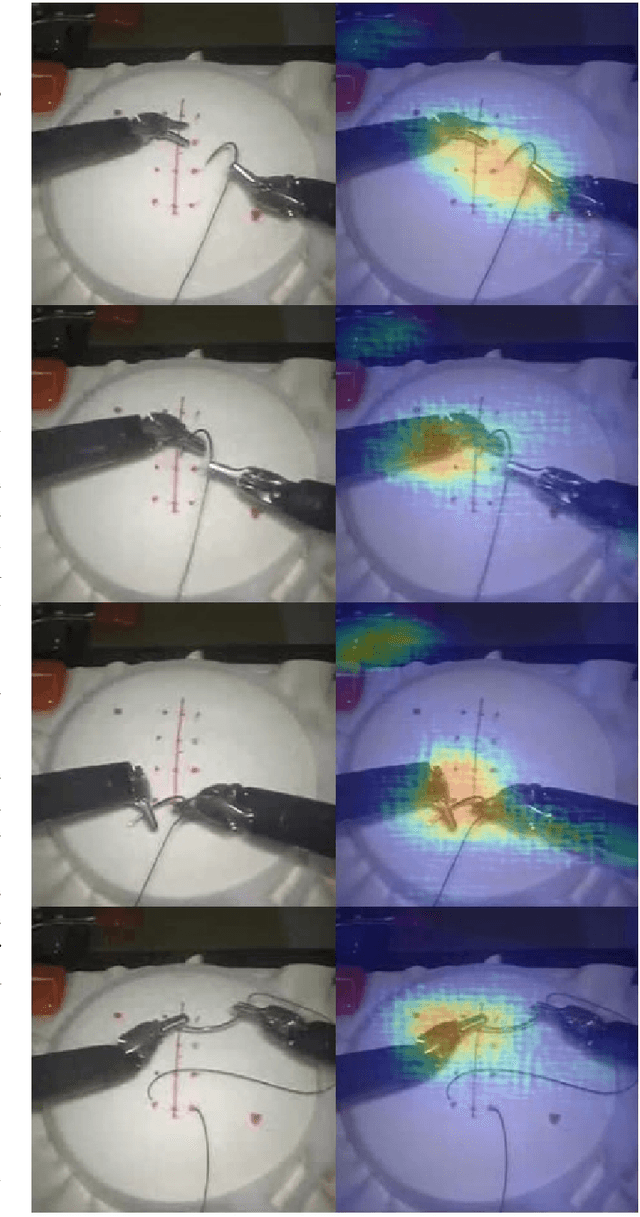 Figure 3 for Using Human Gaze For Surgical Activity Recognition