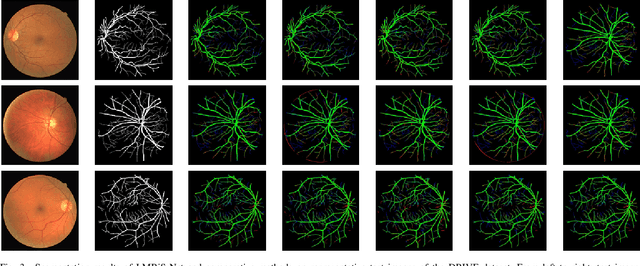 Figure 3 for LMBiS-Net: A Lightweight Multipath Bidirectional Skip Connection based CNN for Retinal Blood Vessel Segmentation