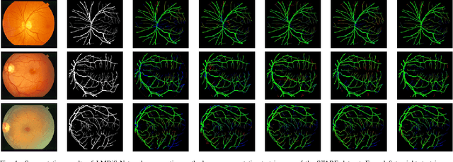 Figure 4 for LMBiS-Net: A Lightweight Multipath Bidirectional Skip Connection based CNN for Retinal Blood Vessel Segmentation