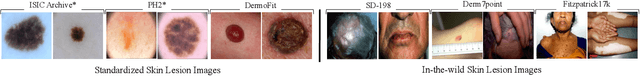 Figure 1 for DermSynth3D: Synthesis of in-the-wild Annotated Dermatology Images