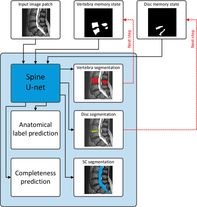 Figure 1 for Lumbar spine segmentation in MR images: a dataset and a public benchmark