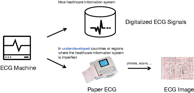 Figure 1 for Artificial Intelligence System for Detection and Screening of Cardiac Abnormalities using Electrocardiogram Images