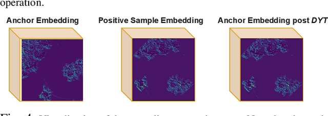 Figure 4 for FinderNet: A Data Augmentation Free Canonicalization aided Loop Detection and Closure technique for Point clouds in 6-DOF separation