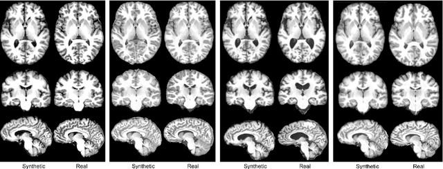 Figure 1 for Metadata-Conditioned Generative Models to Synthesize Anatomically-Plausible 3D Brain MRIs