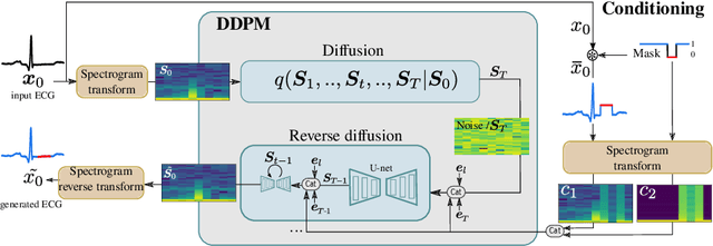 Figure 1 for DiffECG: A Generalized Probabilistic Diffusion Model for ECG Signals Synthesis