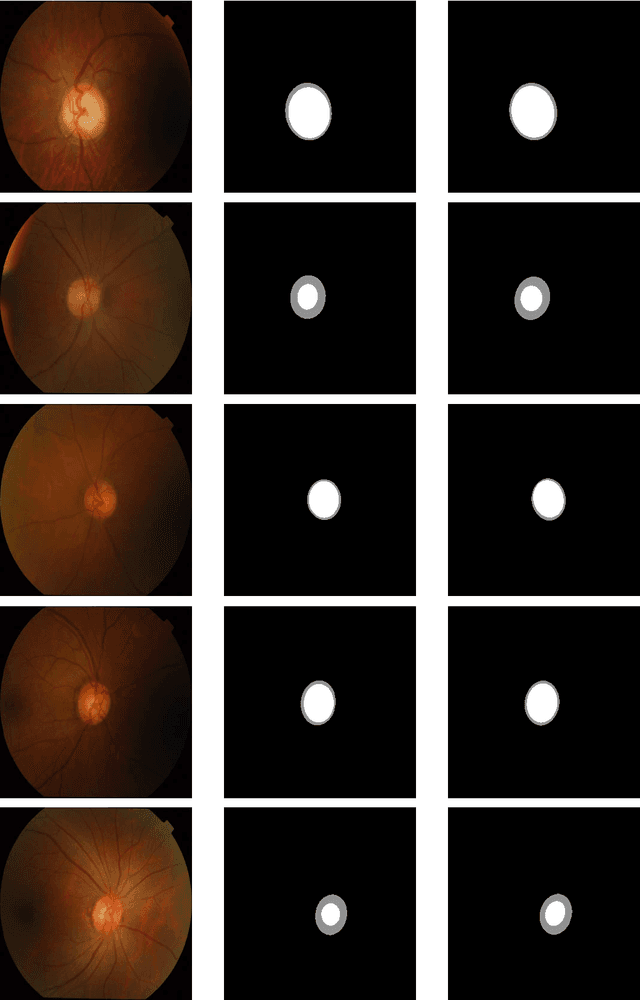 Figure 2 for EDDense-Net: Fully Dense Encoder Decoder Network for Joint Segmentation of Optic Cup and Disc