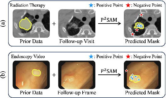 Figure 3 for Part-aware Personalized Segment Anything Model for Patient-Specific Segmentation