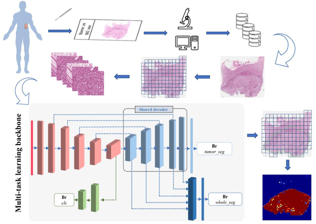 Figure 2 for Artificial intelligence for diagnosing and predicting survival of patients with renal cell carcinoma: Retrospective multi-center study