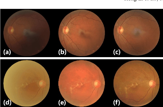 Figure 1 for A Generic Fundus Image Enhancement Network Boosted by Frequency Self-supervised Representation Learning
