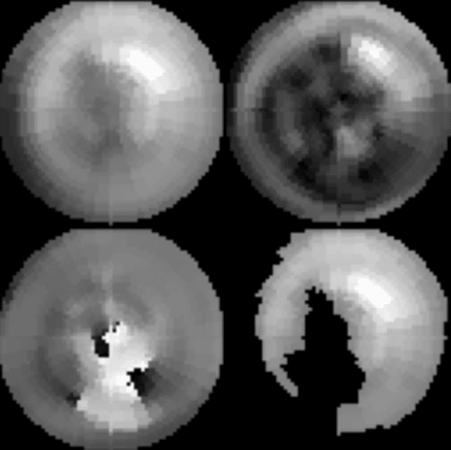 Figure 1 for A new method using deep learning to predict the response to cardiac resynchronization therapy