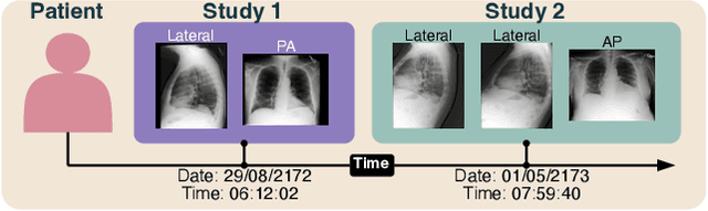 Figure 1 for Longitudinal Data and a Semantic Similarity Reward for Chest X-Ray Report Generation