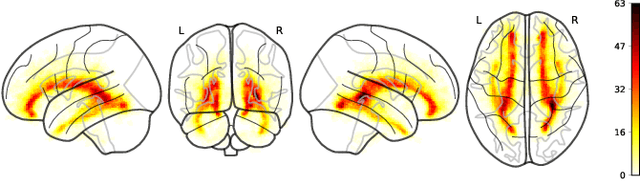 Figure 3 for Spatially Covariant Lesion Segmentation