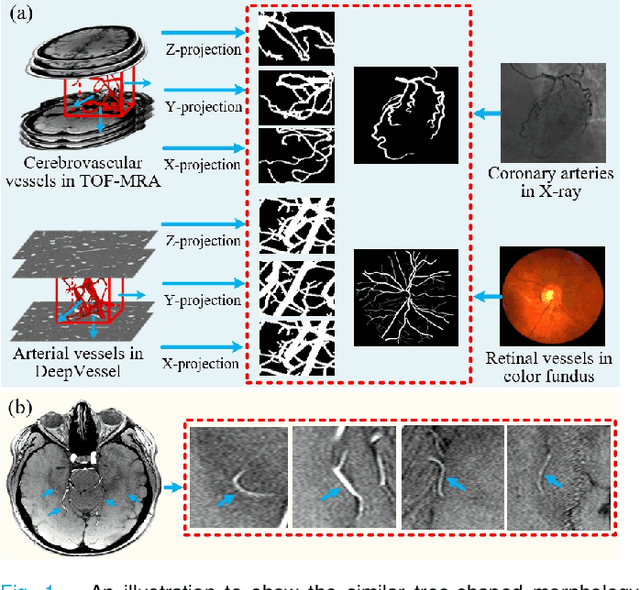 Figure 1 for 3D Vessel Segmentation with Limited Guidance of 2D Structure-agnostic Vessel Annotations