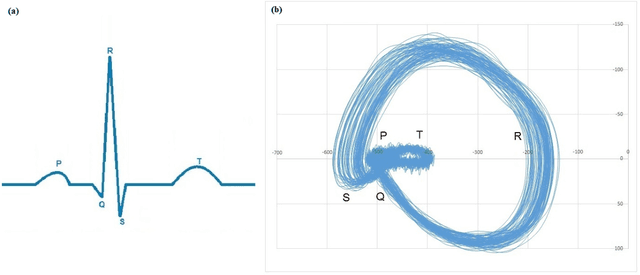Figure 1 for Phase Space Analysis of Cardiac Spectra