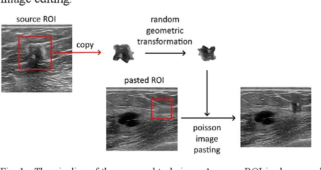Figure 1 for Copy-Paste Image Augmentation with Poisson Image Editing for Ultrasound Instance Segmentation Learning