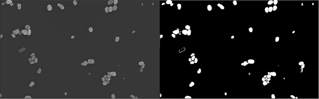 Figure 3 for Recursive Detection and Analysis of Nanoparticles in Scanning Electron Microscopy Images