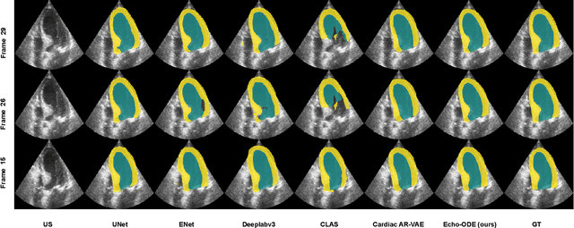 Figure 2 for Echocardiography Segmentation Using Neural ODE-based Diffeomorphic Registration Field