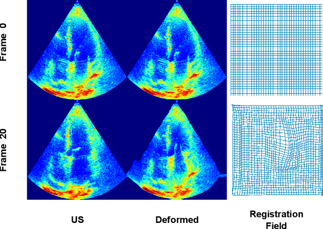 Figure 4 for Echocardiography Segmentation Using Neural ODE-based Diffeomorphic Registration Field