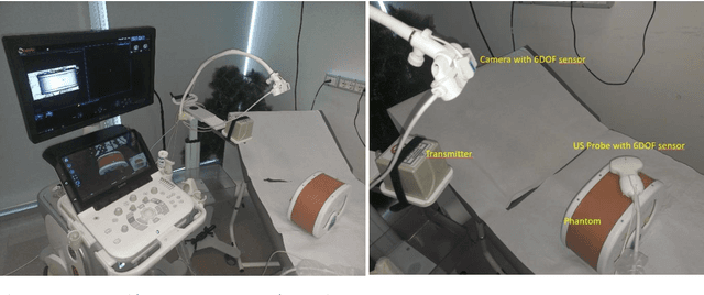 Figure 3 for US & MR Image-Fusion Based on Skin Co-Registration