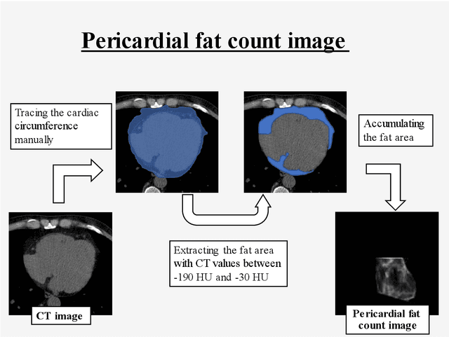 Figure 1 for Development of pericardial fat count images using a combination of three different deep-learning models