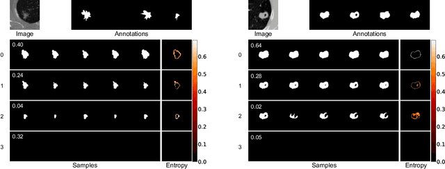 Figure 3 for Modeling Multimodal Aleatoric Uncertainty in Segmentation with Mixture of Stochastic Expert