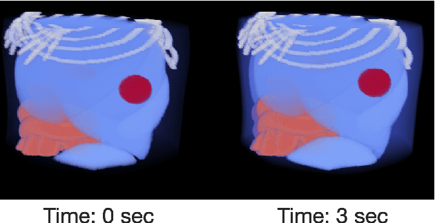 Figure 1 for ProxNF: Neural Field Proximal Training for High-Resolution 4D Dynamic Image Reconstruction