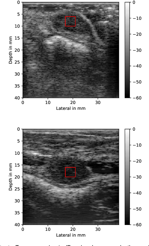 Figure 1 for A Data-Efficient Deep Learning Training Strategy for Biomedical Ultrasound Imaging: Zone Training