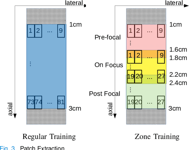 Figure 2 for A Data-Efficient Deep Learning Training Strategy for Biomedical Ultrasound Imaging: Zone Training
