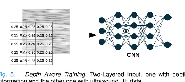 Figure 4 for A Data-Efficient Deep Learning Training Strategy for Biomedical Ultrasound Imaging: Zone Training