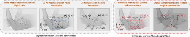 Figure 2 for Can We Revitalize Interventional Healthcare with AI-XR Surgical Metaverses?