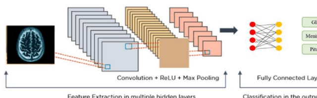 Figure 1 for Brain Tumor classification and Segmentation using Deep Learning