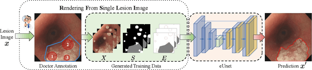 Figure 3 for Single-Image-Based Deep Learning for Segmentation of Early Esophageal Cancer Lesions