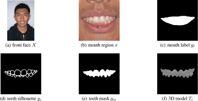 Figure 1 for OrthoGAN:High-Precision Image Generation for Teeth Orthodontic Visualization